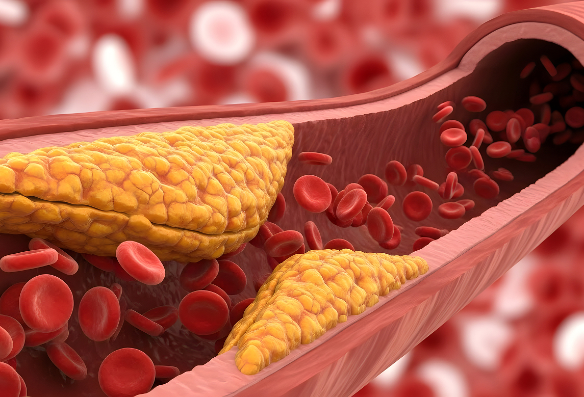liposcale test